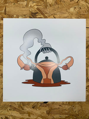Uterus Kettle Print